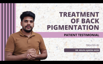 Back Pigmentation | Patient Testimonial for Dermatologist Dr. Krupa