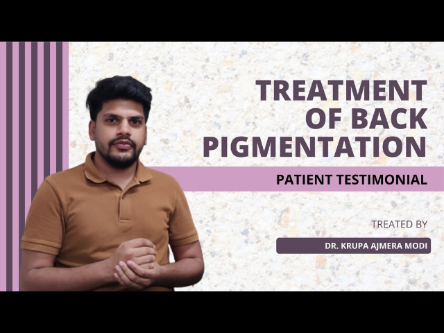 Back Pigmentation | Patient Testimonial for Dermatologist Dr. Krupa