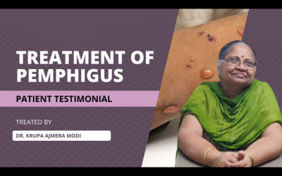 Patient testimonial | A Decade of Struggle, Finally Triumph | Pemphigus | Dr. Krupa Ajmera Modi