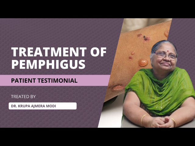 Patient testimonial | A Decade of Struggle, Finally Triumph | Pemphigus | Dr. Krupa Ajmera Modi