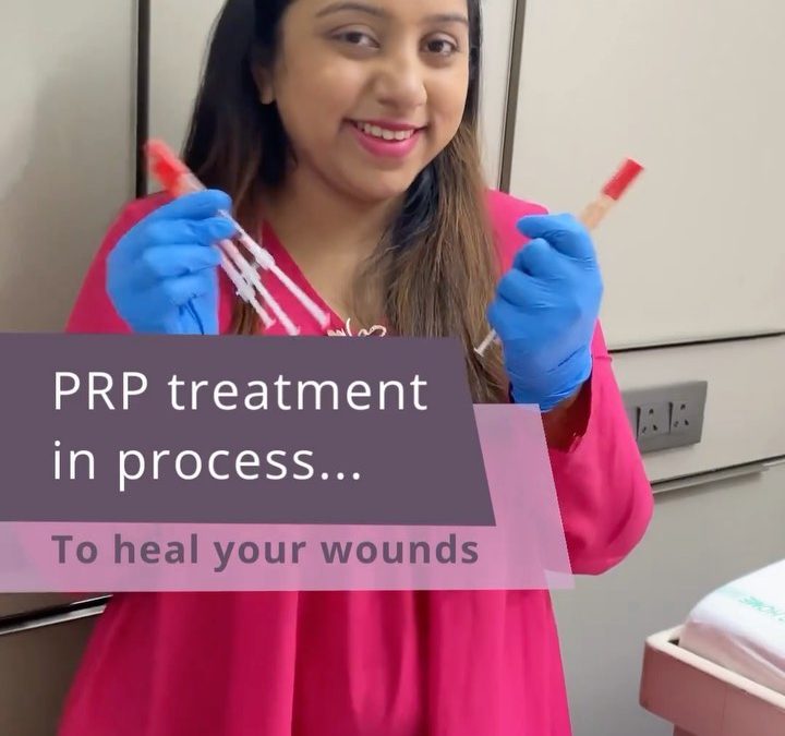 PRP treatment in process…