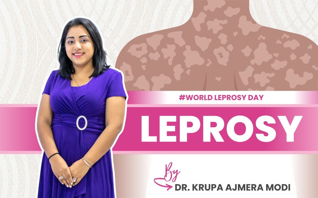 World Leprosy Day: Effects, Treatment & Prevention | Dr. Krupa Ajmera Modi