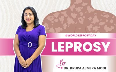 World Leprosy Day: Effects, Treatment & Prevention | Dr. Krupa Ajmera Modi