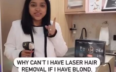 Lasers love dark hair!!