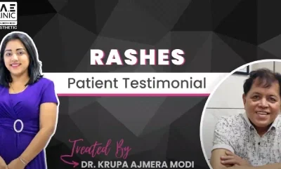 Rapid Relief from Rash Infections | Dr. Krupa Modi’s Expertise